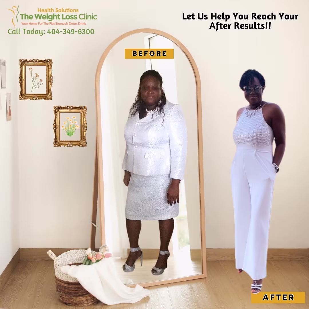 Before & After 2 Before and after weight loss photos of a female client