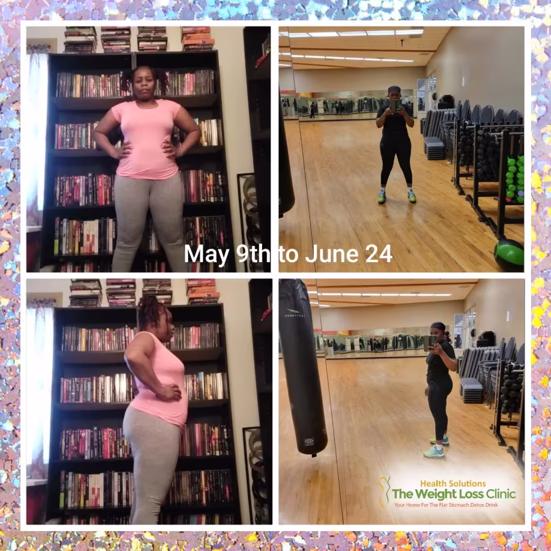 Before & After 3 Collage of client before and after weight loss photos