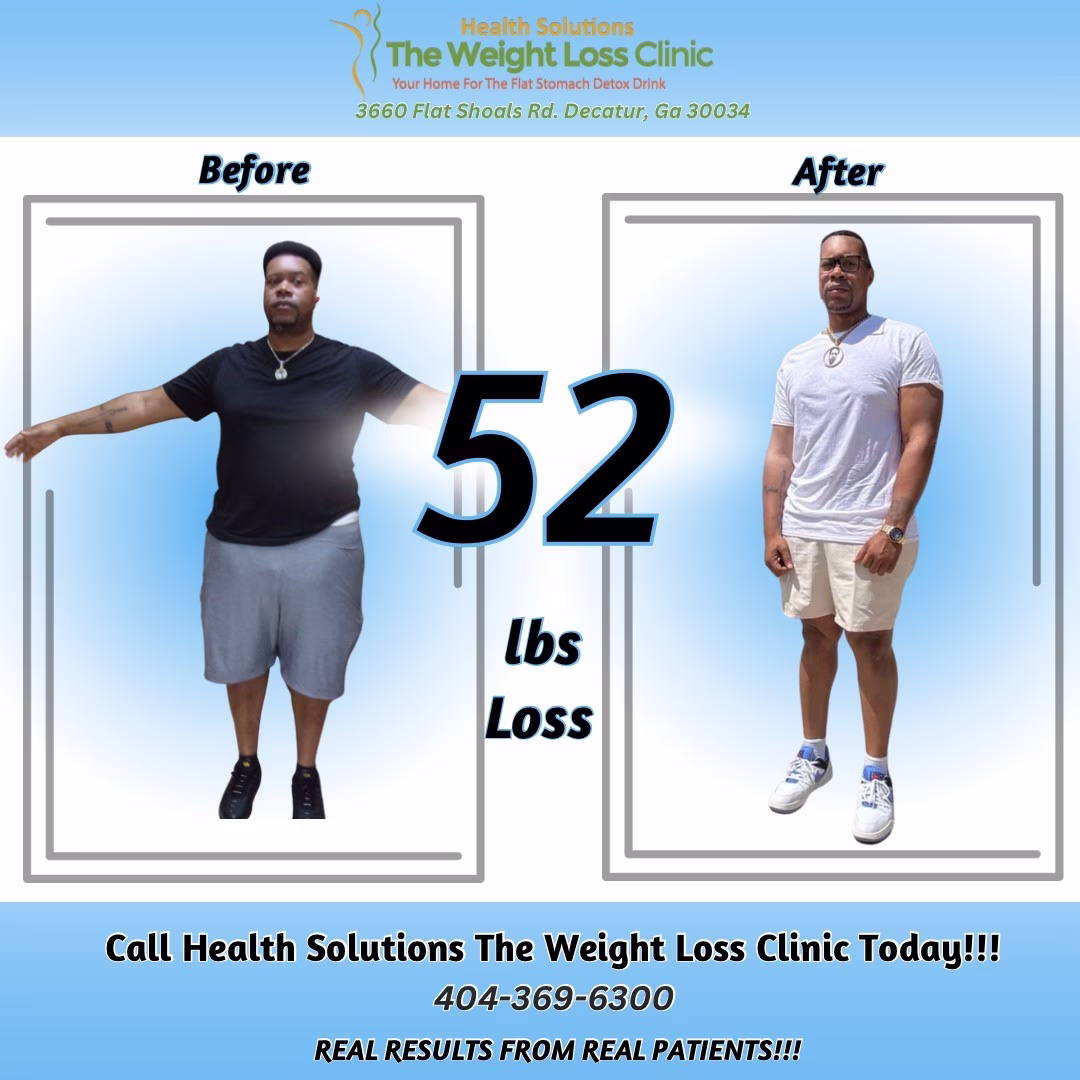 Before & After 5 Before and after graphic of a male client who lost 52 lbs