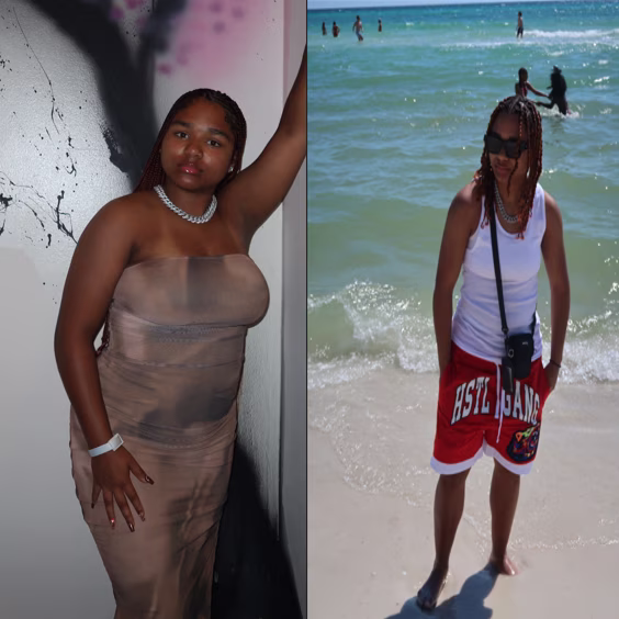 Pic-3-1 Client before and after weight loss photos
